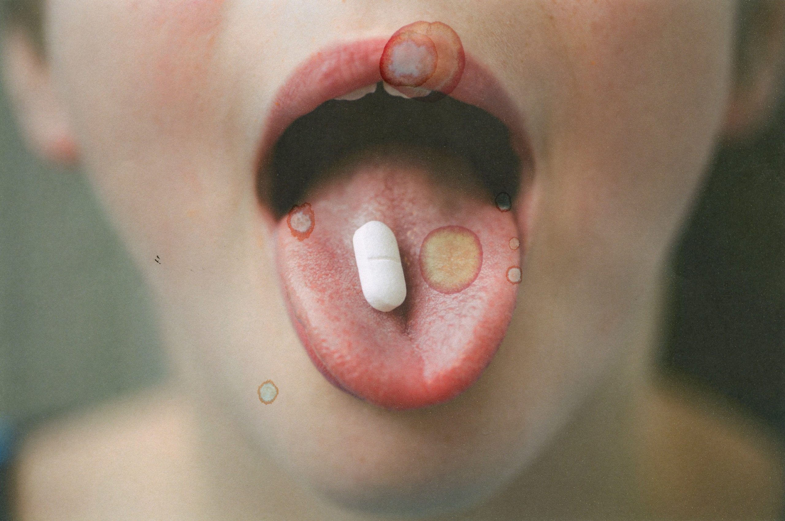 Kind schluckt Antibiotika