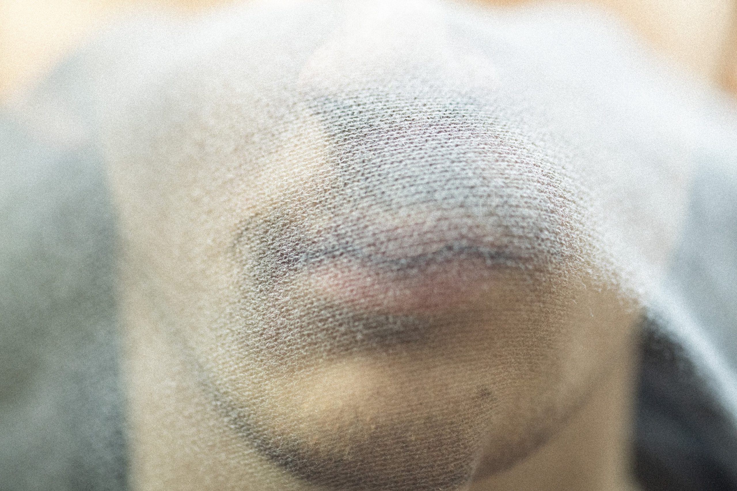 Nase und Mund eines männlichen Gesichts werden von einem Musselintuch verdeckt.