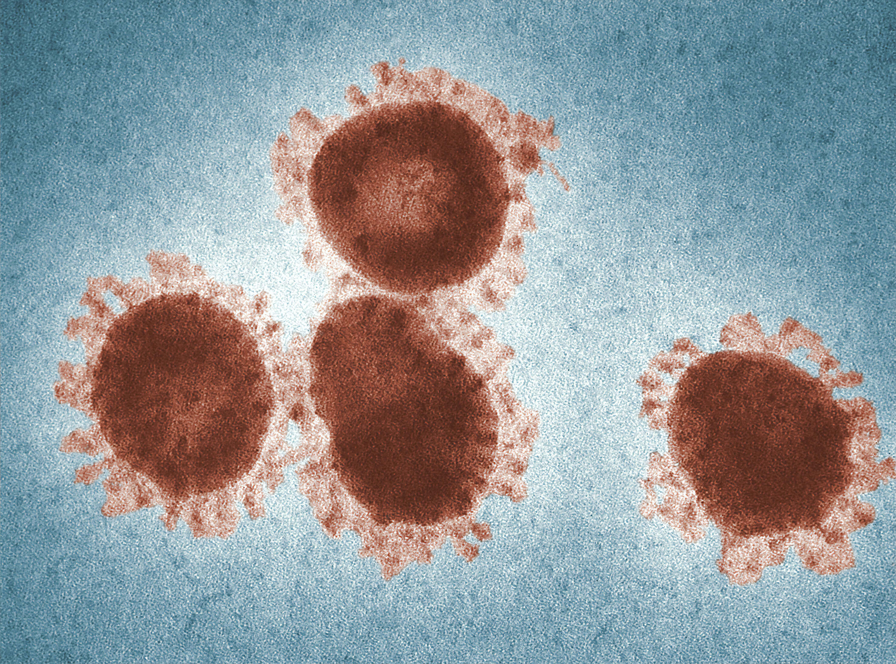 Мало коронавирус. Коронавирус SARS cov 2 под микроскопом. Коронавирус под микроскопом. Коронавирус в микроскопе. Атипичная пневмония (SARS).