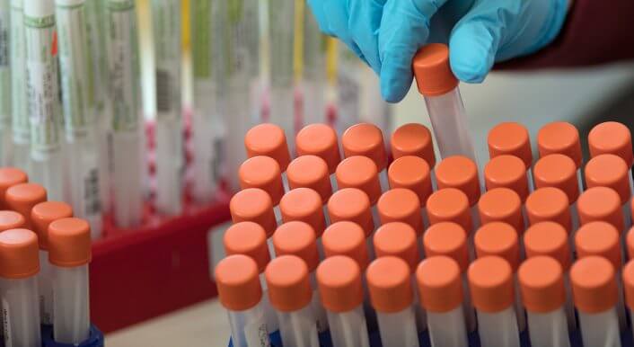 PCR-Tests auf das Coronavirus im Labor