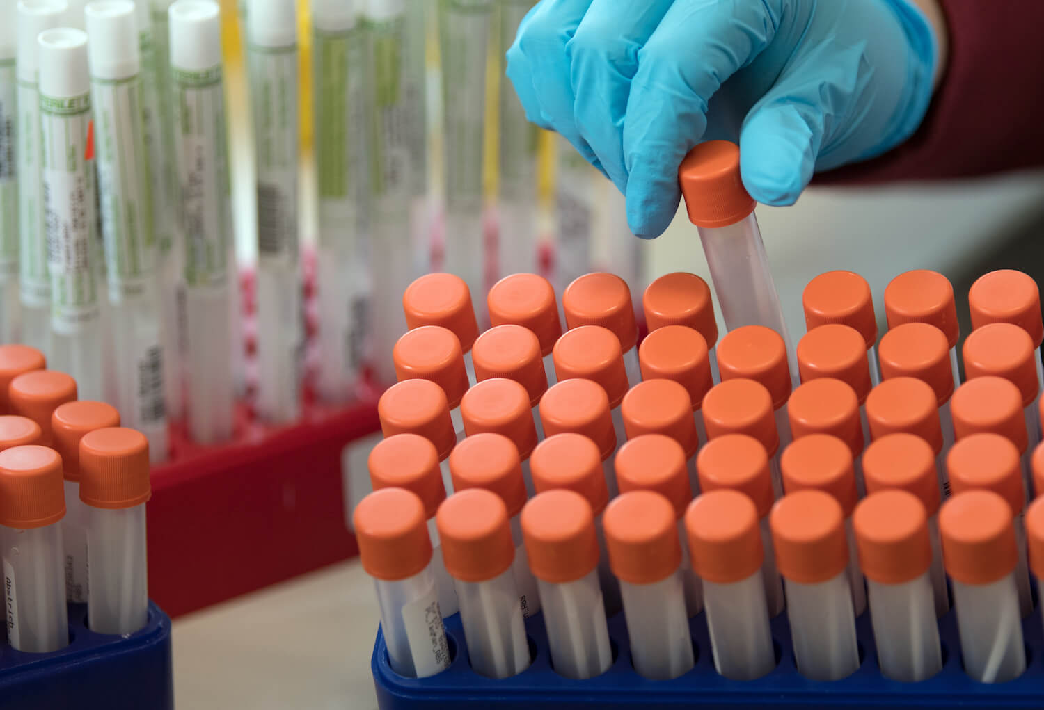 PCR-Tests auf das Coronavirus im Labor