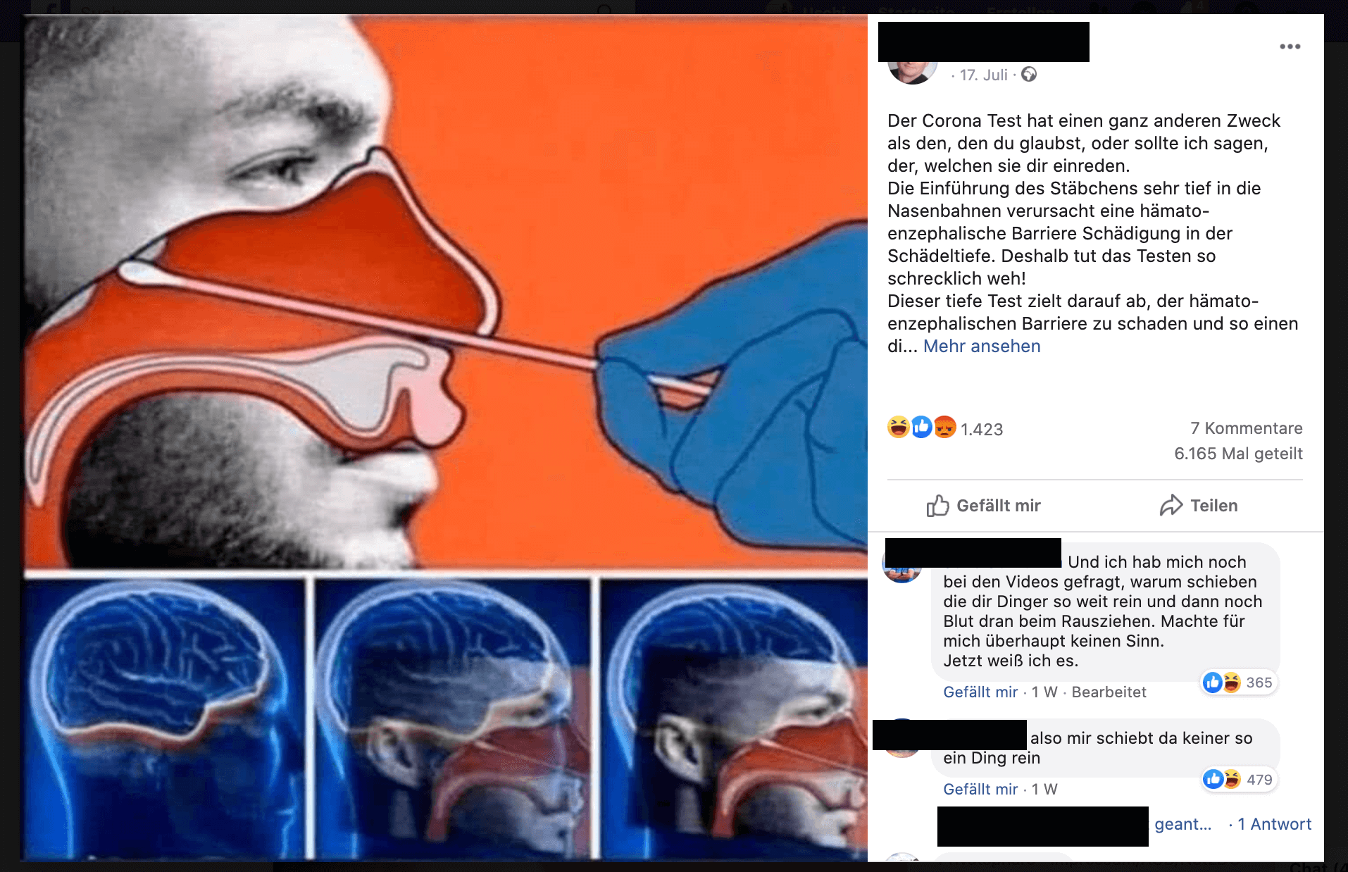 Es stimmt nicht, wie hier in einem Facebook-Beitrag behauptet, dass durch den Corona-Test Verletzungen an der Schädeldecke oder dem Gehirn verursacht werden können. (Quelle: Facebook, Screenshot und Schwärzungen: CORRECTIV)