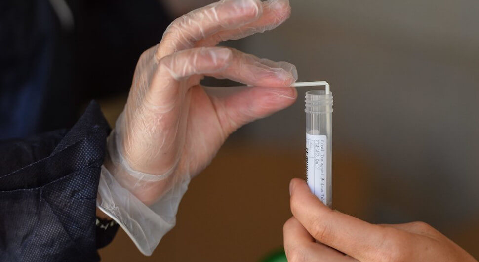 PCR-Test auf SARS-CoV-2: Warum in der Praxis falsch-positive Ergebnisse selten sind