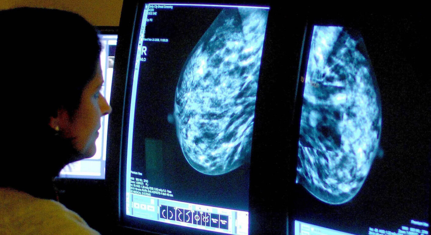 Radiologin bei Mammografie