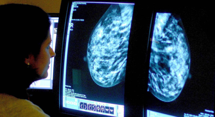Ärztin sieht sich Mammografie-Ergebnisse an