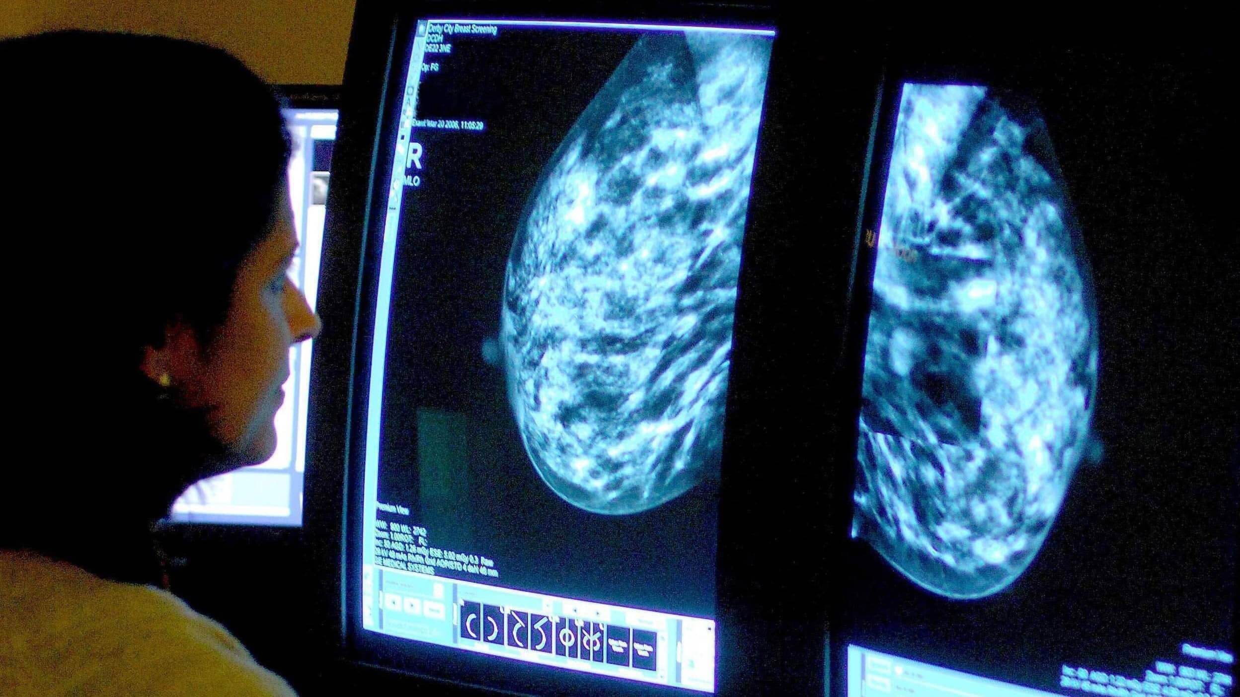 Ärztin sieht sich Mammografie-Ergebnisse an