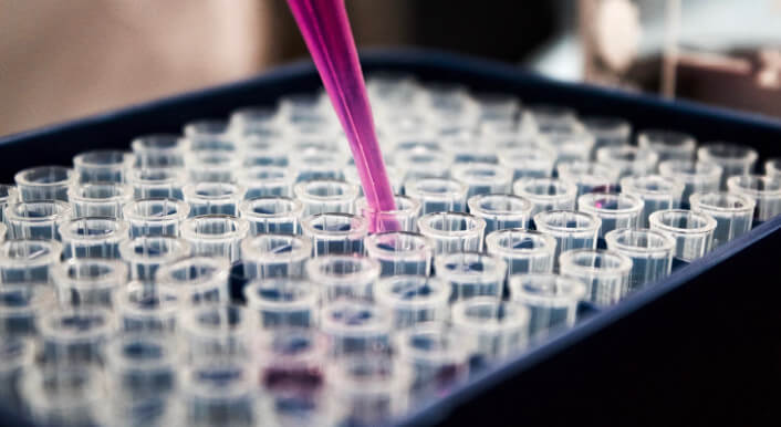 Eine pinke Pipette und mehrere Reagenzgläser in einer schwarzen Schale