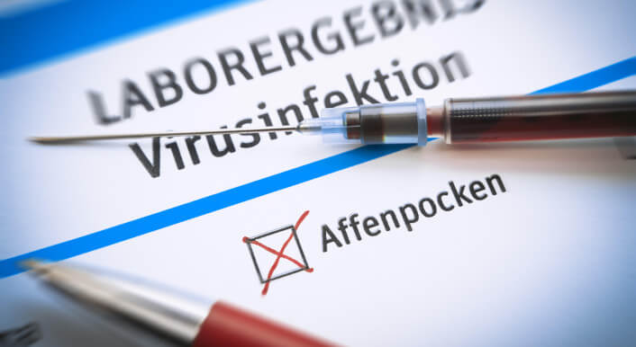 Positives Testergebnis einer Affenpocken-Infektion