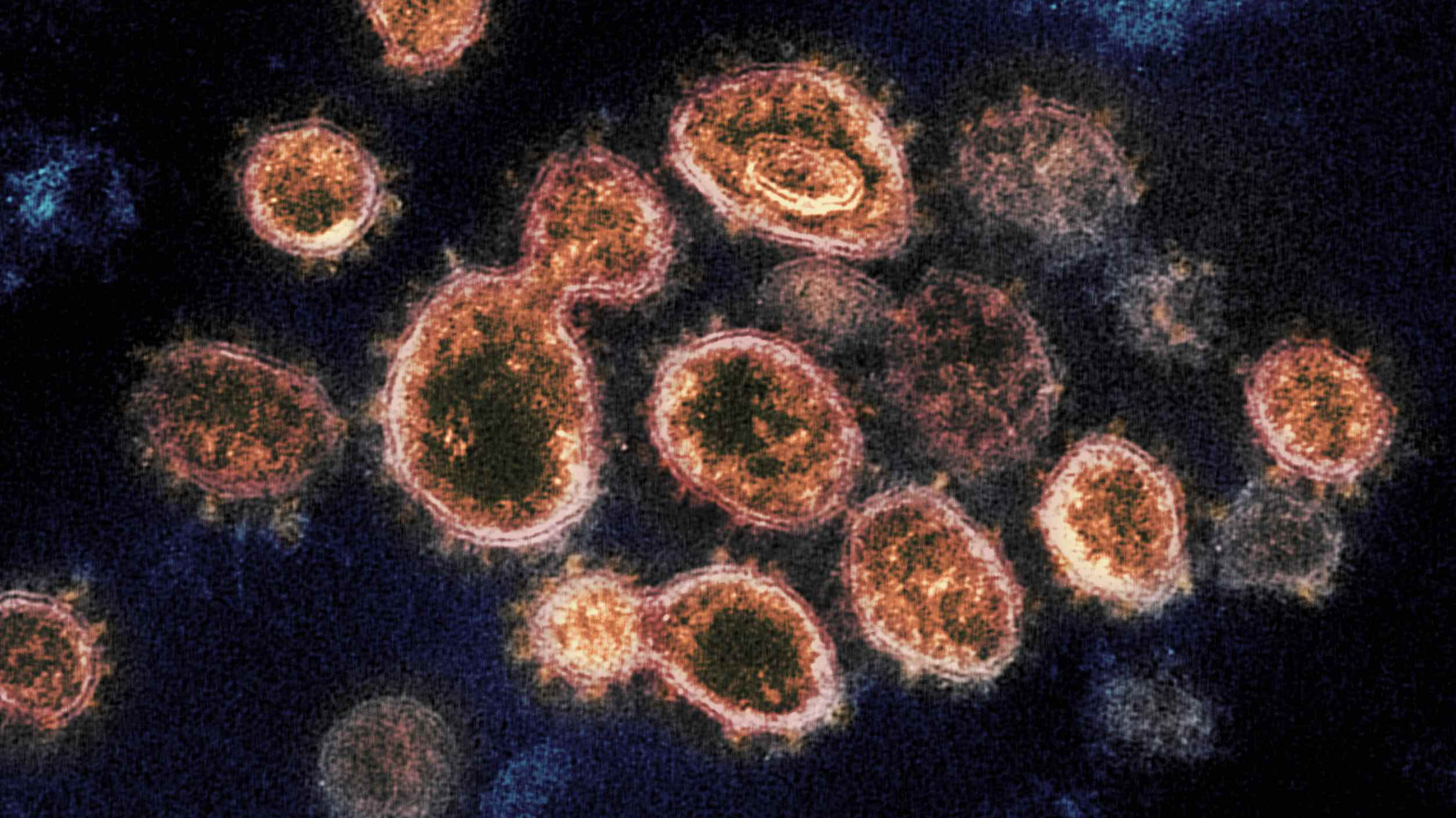 Diese Aufnahme zeigt das Virus SARS-CoV-2, isoliert von einem Patienten in den USA. Das Bild veröffentlichte das US-Institut für Allergien und Infektionskrankheiten Niaid im Februar 2020.
