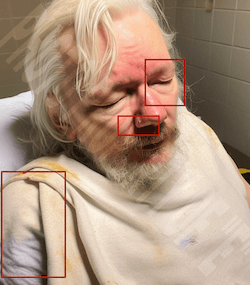 Fehler im Bild von Julian Assange sind rot markiert.