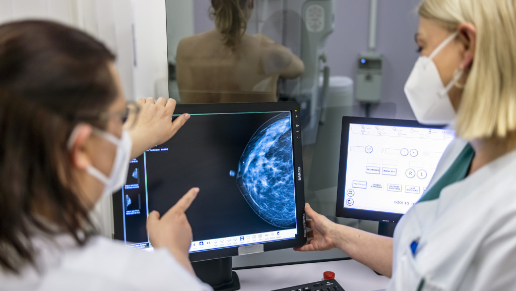 Krebsdiagnose-Verfahren: Medizinisches Personal untersucht bei einer Mammografie eine Frau auf Brustkrebs